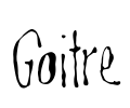 Goitre